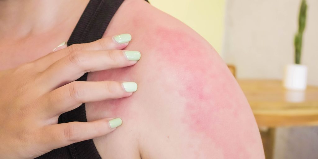 acidic well water - common issue 